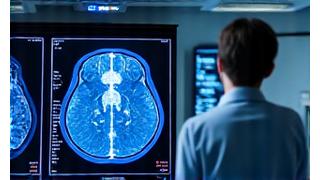 AI analyzing medical MRI scan
